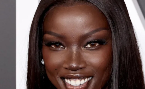 SUPERMODEL ANOK YAI SLAMS CRUDE TOILET RUMOUR ABOUT MET GALA DRESS